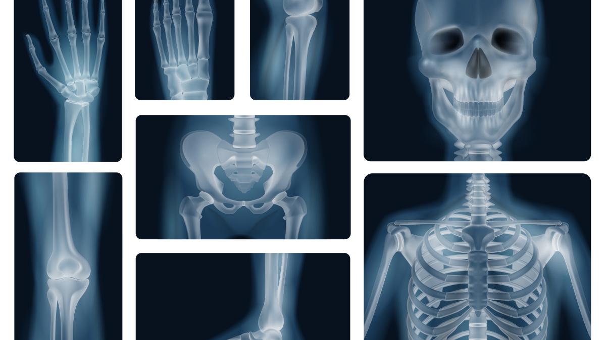 radiografiile--intre-riscuri-si-beneficii-_68061700