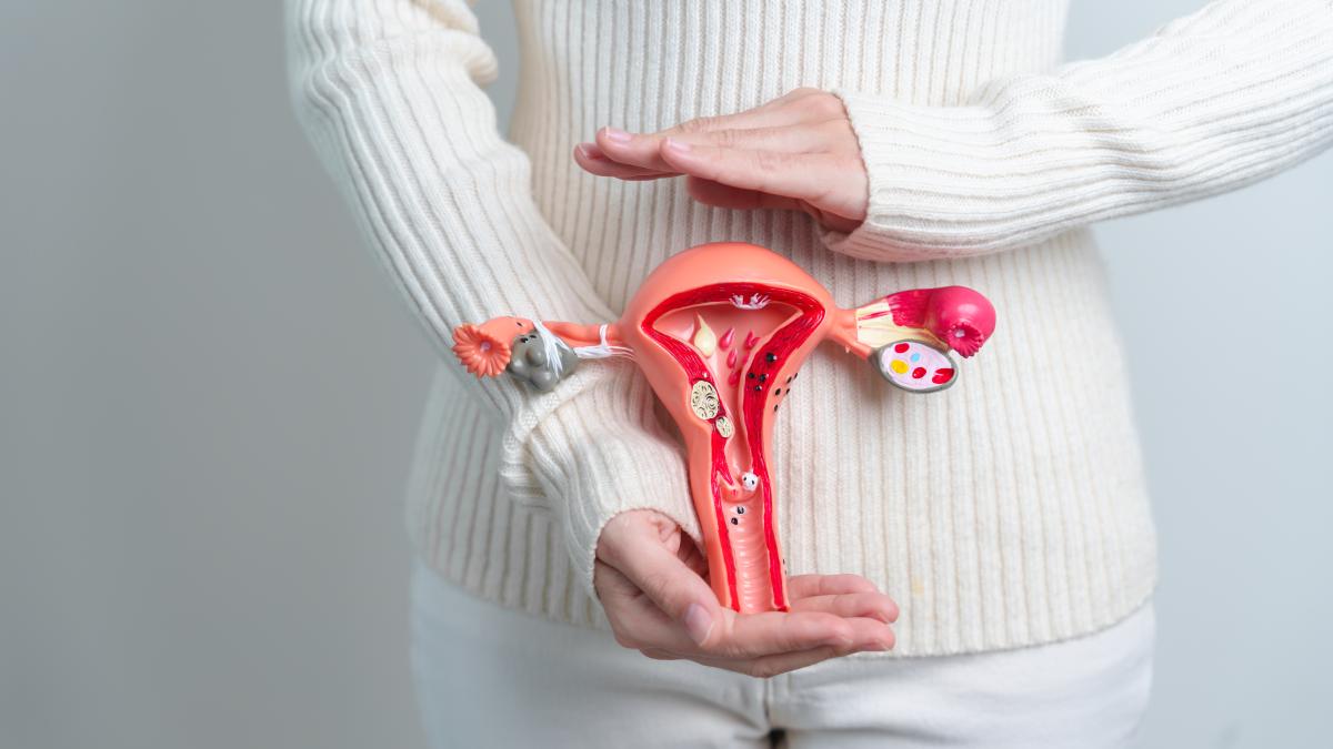 endometrioza--cauze-genetice_04769700