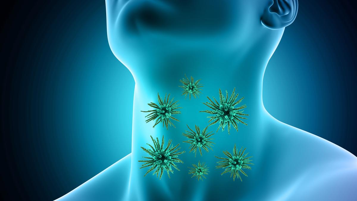 tratamentul-care-distruge-cancerul-de-gat_04637200