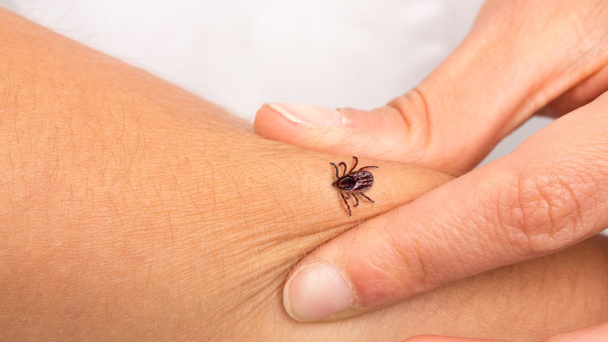 a-inceput-sezonul-capuselor--cum-sa-va-protejati-de-acestea-si-ce-trebuie-sa-faceti-in-cazul-muscaturii-de-capusa_69463600