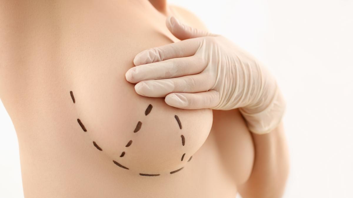 cele-3-semne-de-avertizare-ale-cancerului-de-san-pe-care-nicio-femeie-nu-trebuie-sa-le-ignore_63970200