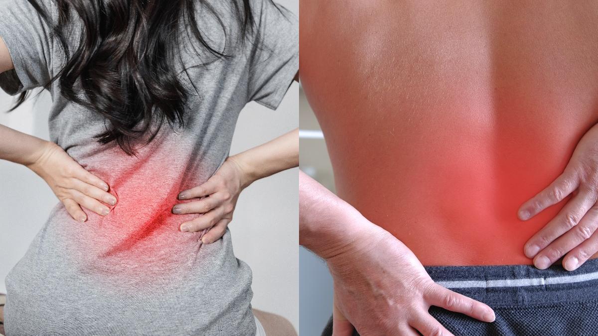 lombosciatica--afectiunea-frecventa-cu-dureri-fulgeratoare_72749600