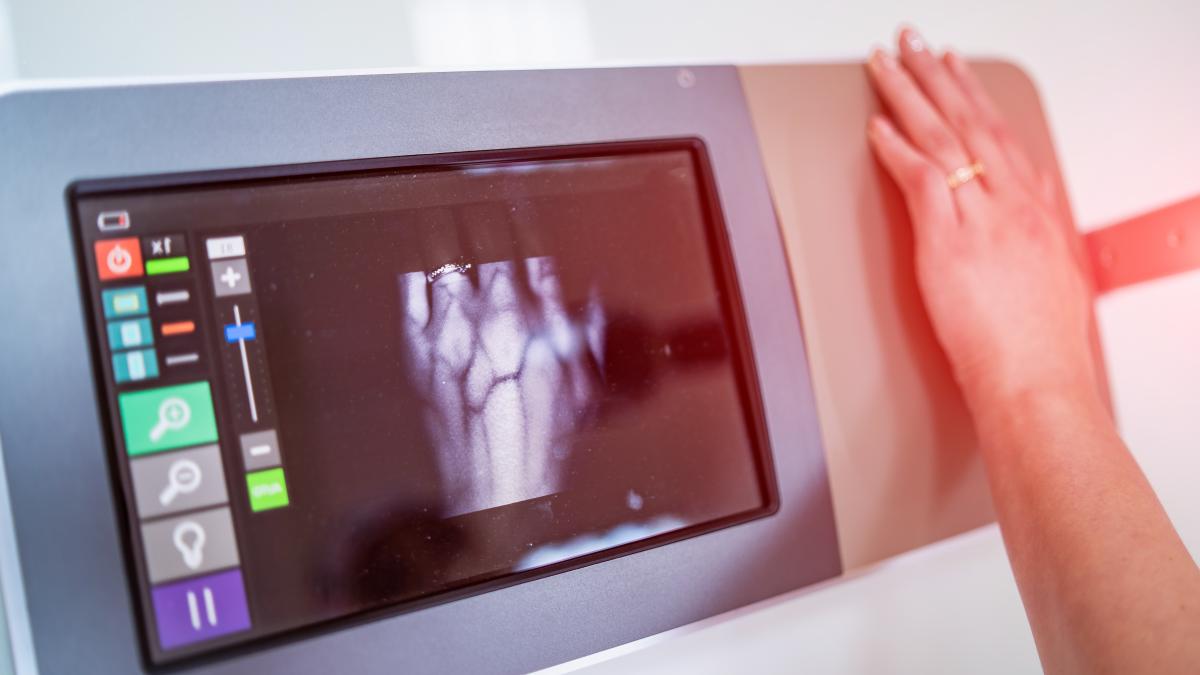 angiografia--tehnica-ce-pune-diagnosticul-de-cancer-fara-biopsie--radu-deac-nu-mai-e-nevoie-de-biopsie-descopera-imediat-tumorile-maligne_89685700