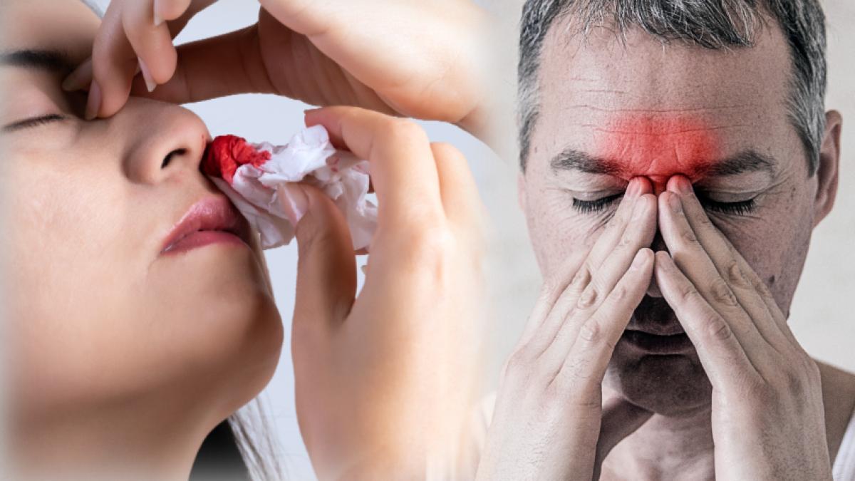 sangerare-nazala-10-probleme-pe-care-le-poti-avea--ce-sa-faci-cand-iti-curge-sange-din-nas-si-cum-opresti-sangerarea--de-ce-pozitia-pe-spate-e-gresita_56621200