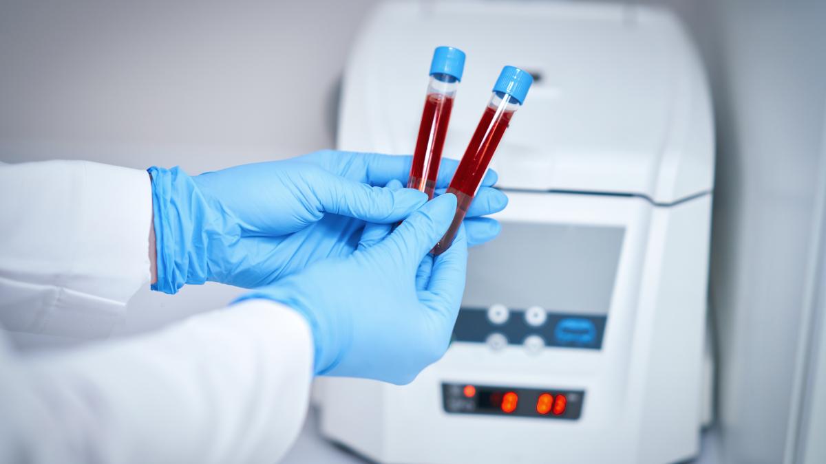 testul-de-sange-care-poate-depista-50-de-tipuri-de-cancer--85prc--din-pacienti--testati-pozitiv-depisteaza-multe-tipuri-de-cancer-in-stadiu-incipient--ajutam-la-salvarea-a-mii-de-vieti-2_19640100