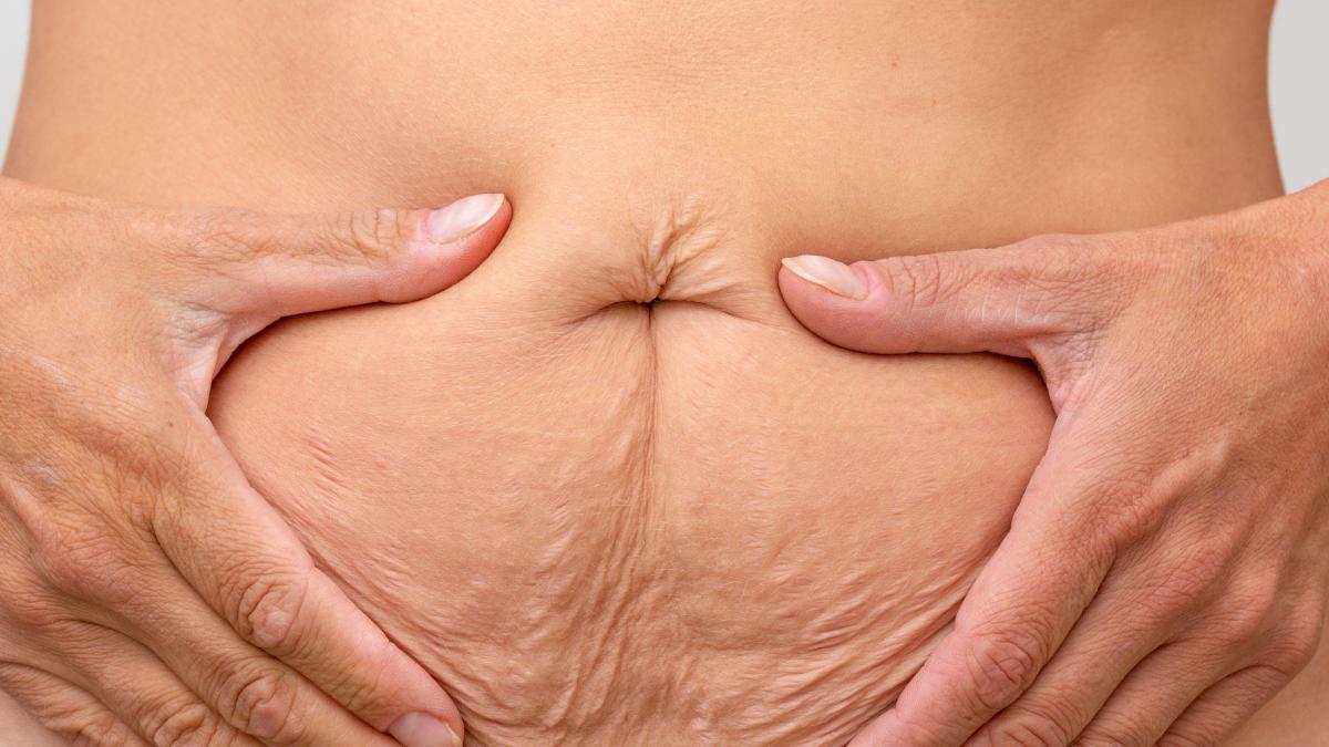 cortizolul--motivul-grasimii-de-pe-burta--ce-este-si-cum-putem-sa-scadem-nivelul-de-cortizol-faceti-asta-timp-de-10-minute_00542000