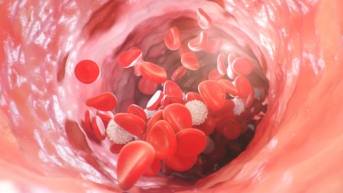 testul-care-iti-arata-daca-ai-anemie--buliga-asa-gasim-cancerul-de-colon-la-pacienti--se-vede-cu-ochiul-liber_42464200