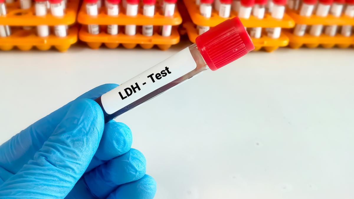 ldh--lactat-dehidrogenaza-ce-este--cand-trebuie-sa-faci-testul-si-ce-boli-gaseste--ce-inseamna-daca-ai-ldh-mare-si-ce-inseamna-daca-ai-ldh-scazut_35609900