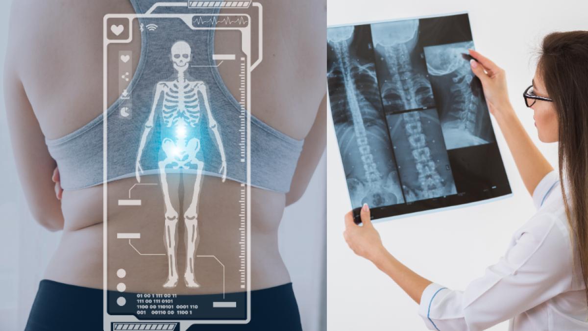 dexa-totul-despre-testul-de-osteodensitometrie--ce-trebuie-sa-stii-daca-ai-peste-50-de-ani-si-care-sunt-valorile-normale-ale-dexa_70490200