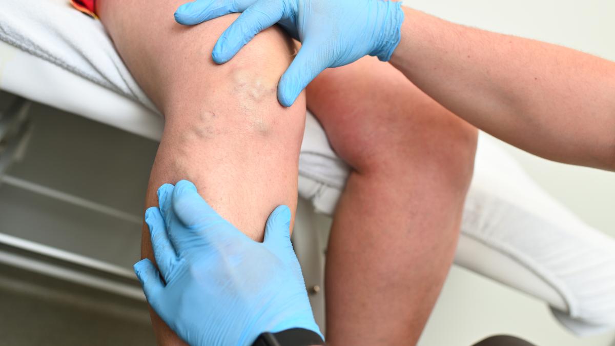 angiografia--procedura-de-vizualizare-a-venelor--identifica-zonele-blocate-din-vasele-de-sange-si-depisteaza-anevrismele_96209000