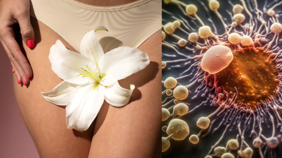 candidoza-cauze--simptome--tratament-naturist--alimentele-care-hranesc-candida-si-cum-o-distrugi-definitiv-bautura-asta--inainte-de-culcare--este-minunata_86929500