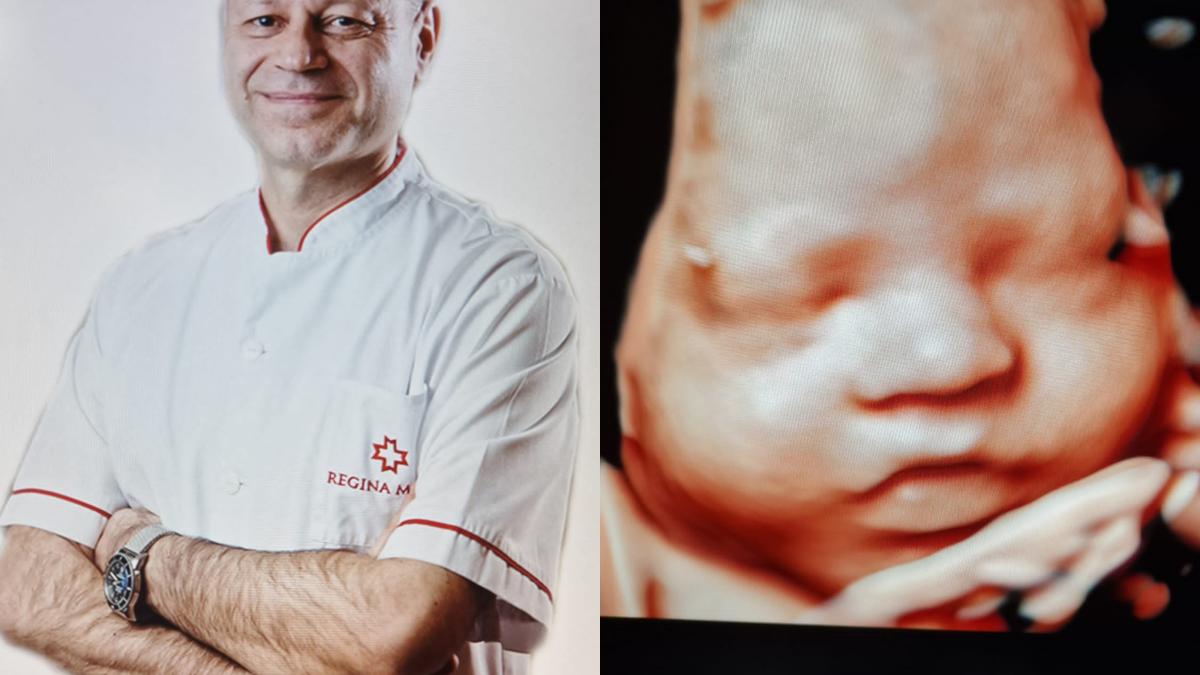 ecograf-de-ultima-generatie-in-romania--george-marinescu--medicul-care-lucreaza-cu-_cel-mai-performant-ecograf-pe-plan-mondial__-ajuta-enorm-in-elucidarea-unor-probleme-de-diagnostic_72350500