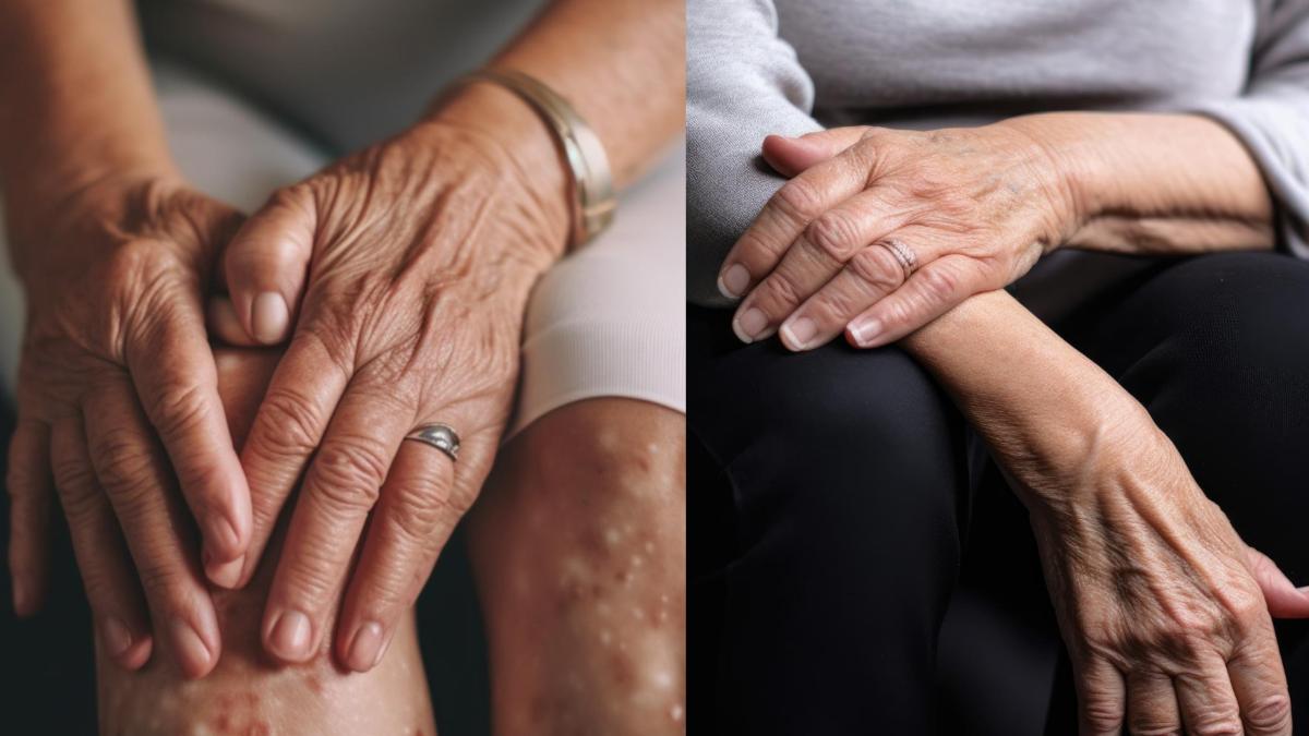 reumatism_-sfaturi-si-remedii--cum-il-ameliorezi-acasa--la-ce-ajuta-compresele-reci-sau-calde_35029700