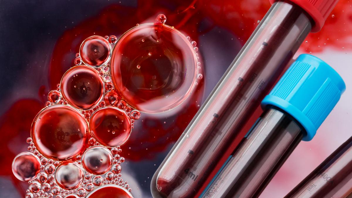 testul-simplu-care-iti-arata-daca-ai-cancer-de-col-uterin--semnul-din-analiza-de-sange--beatrice-anghel_-e-clar-daca-sunt-tumori-local-avansate_69018700