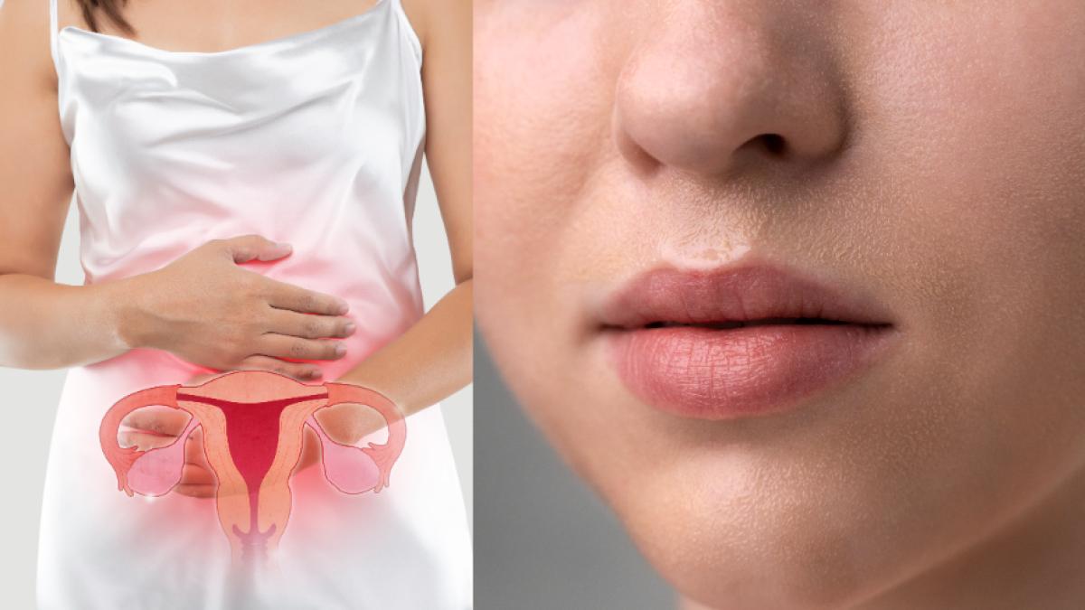 sindromul-ovarelor-polichistice-primele-semne-si-tratament--testele-care-pun-diagnosticul_30553400
