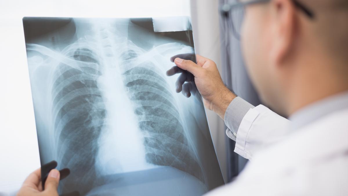 ce-este-reabilitarea-pulmonara-si-cum-se-face-_11957000
