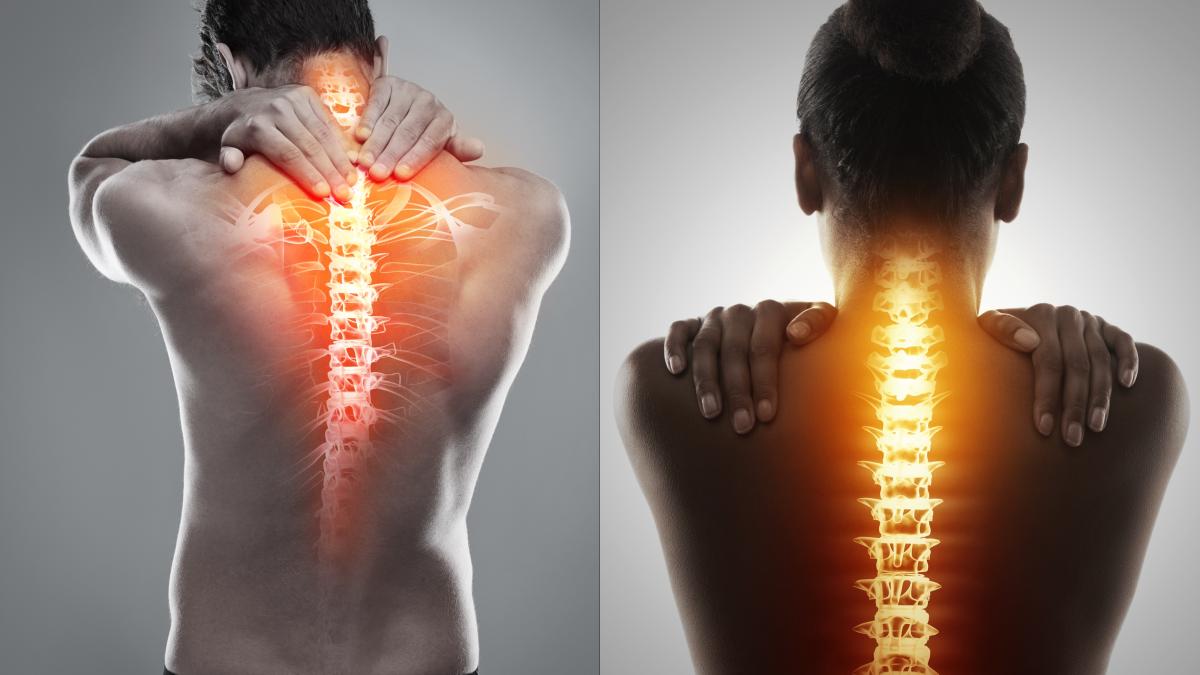 spondiloza-cervicala_-simptome--cauze--tratament--testul-simplu-care-pune-diagnosticul--de-ce-sa-ti-pui-comprese_12320100