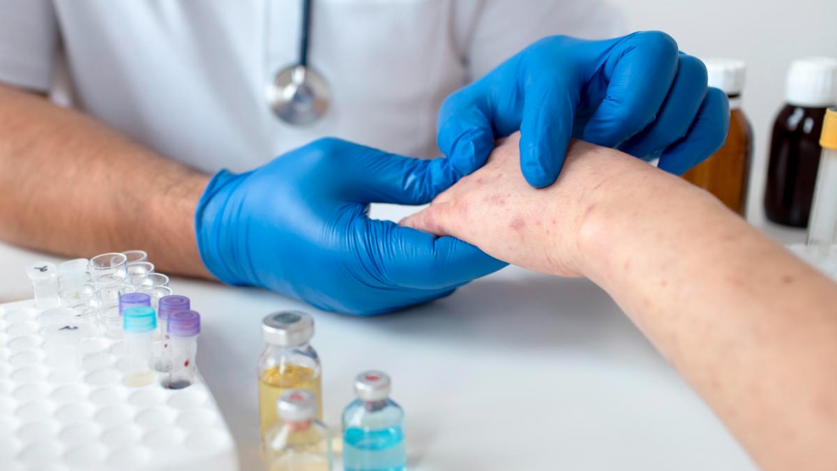 lupus--eroarea-sistemului-imunitar_35484500