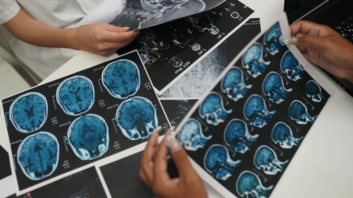tumoare-cerebrala-agresiva--confundata-cu-apendicita_89266900