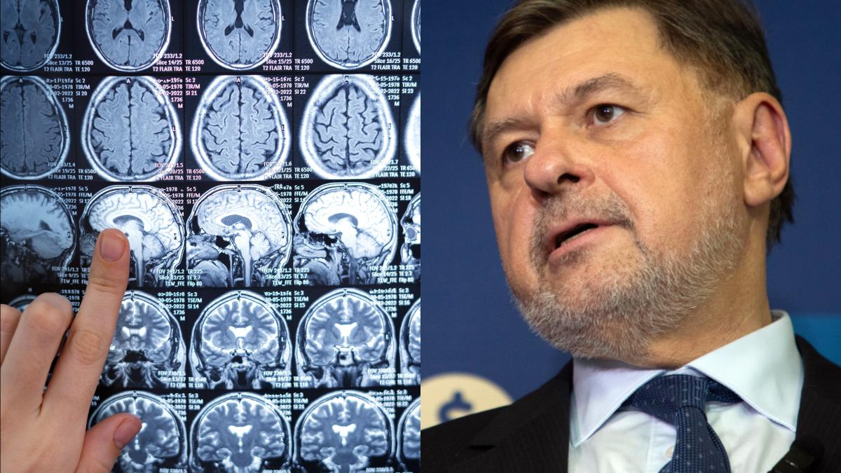 rafila-pana-la-sfarsitul-anului-vom-avea-primele-generatii-de-interventionisti-in-domeniul-accidentelor-cerebrovasculare_89814600