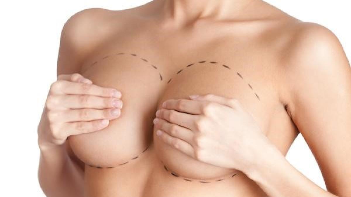 cand-este-recomandata-operatia-de-reductie-mamara_76612100