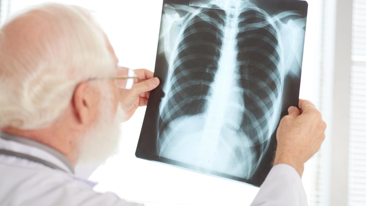 tuberculoza-cauze--simptome--preventie--ce-ar-trebui-sa-stie-persoanele-care-calatoresc_61018000