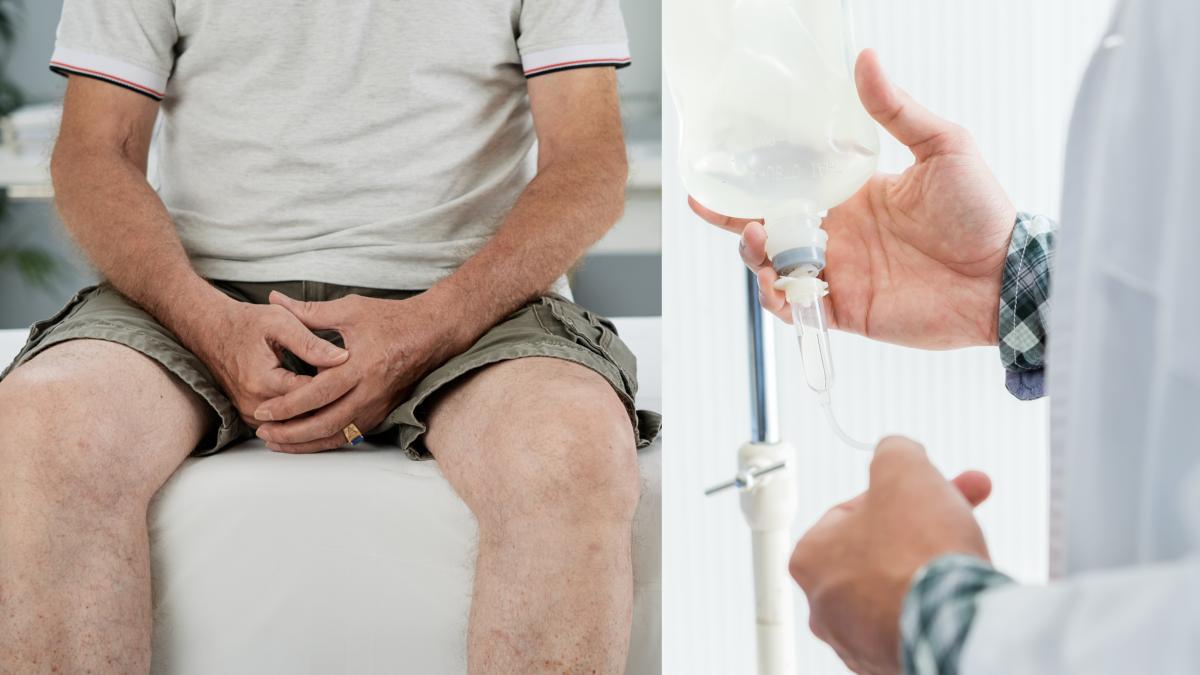 instilatiile--terapia-care-distruge-celulele-canceroase--bogdan-parliteanu_-se-fac-in-ambulator-si-dureaza-45min---1h--reduc-recidivele--pentru-ca-asta-e-parsivitatea-acestui-tip-de-cancer_45480800