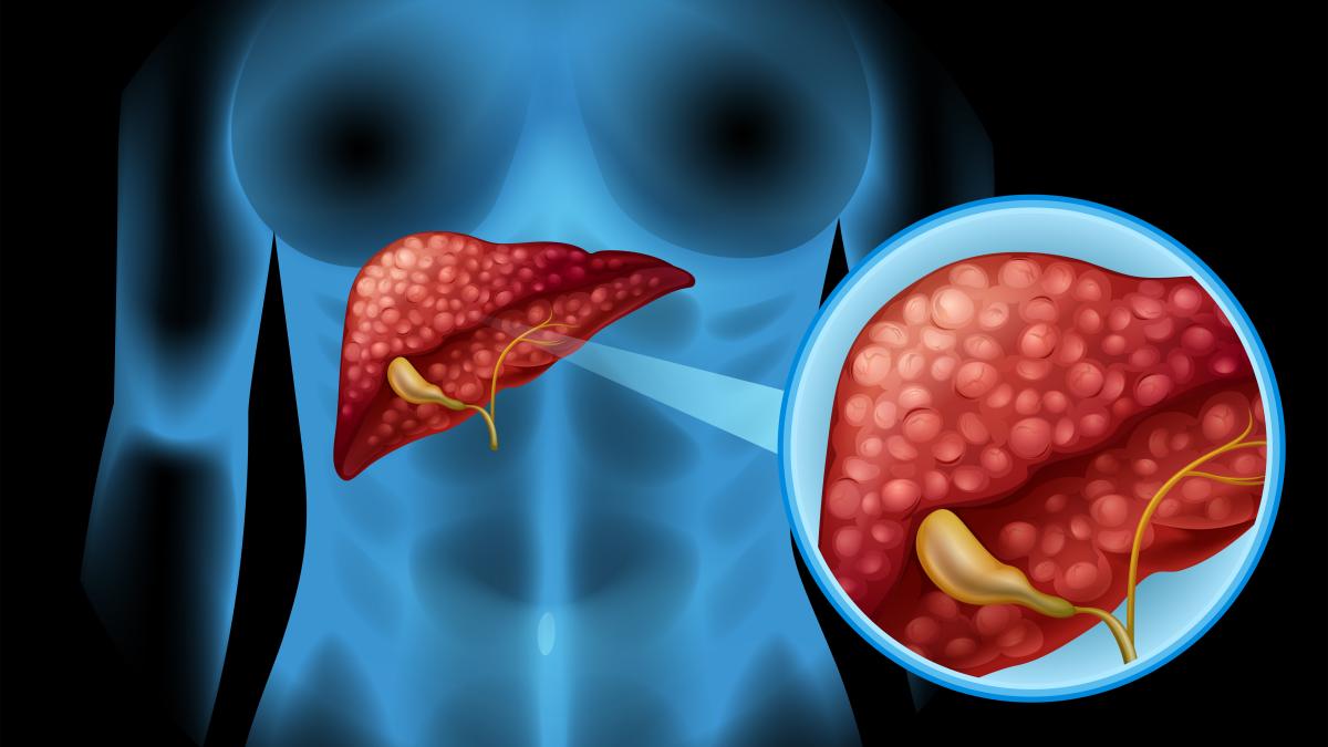 cancerul-cu-cea-mai-fatala-evolutie_50551000