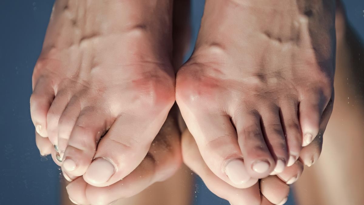 hallux-valgus-monturi-os-degete-3_12302700