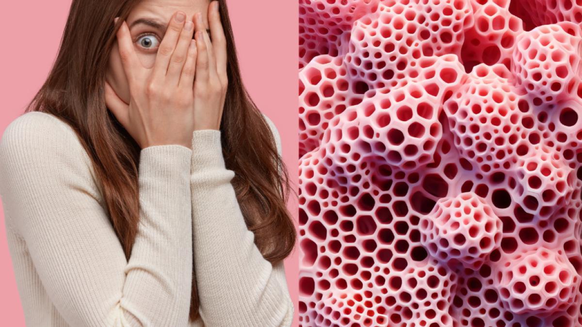 trypophobia-1_07976100