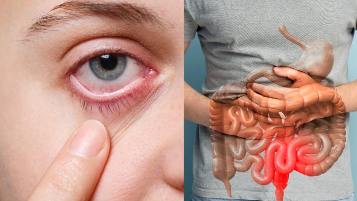 hepatita-d-primele-semne--liana-gheorghe-le-ignora-si-ajung-cu-hemoragie-digestiva-sau-icter-franc_14958700