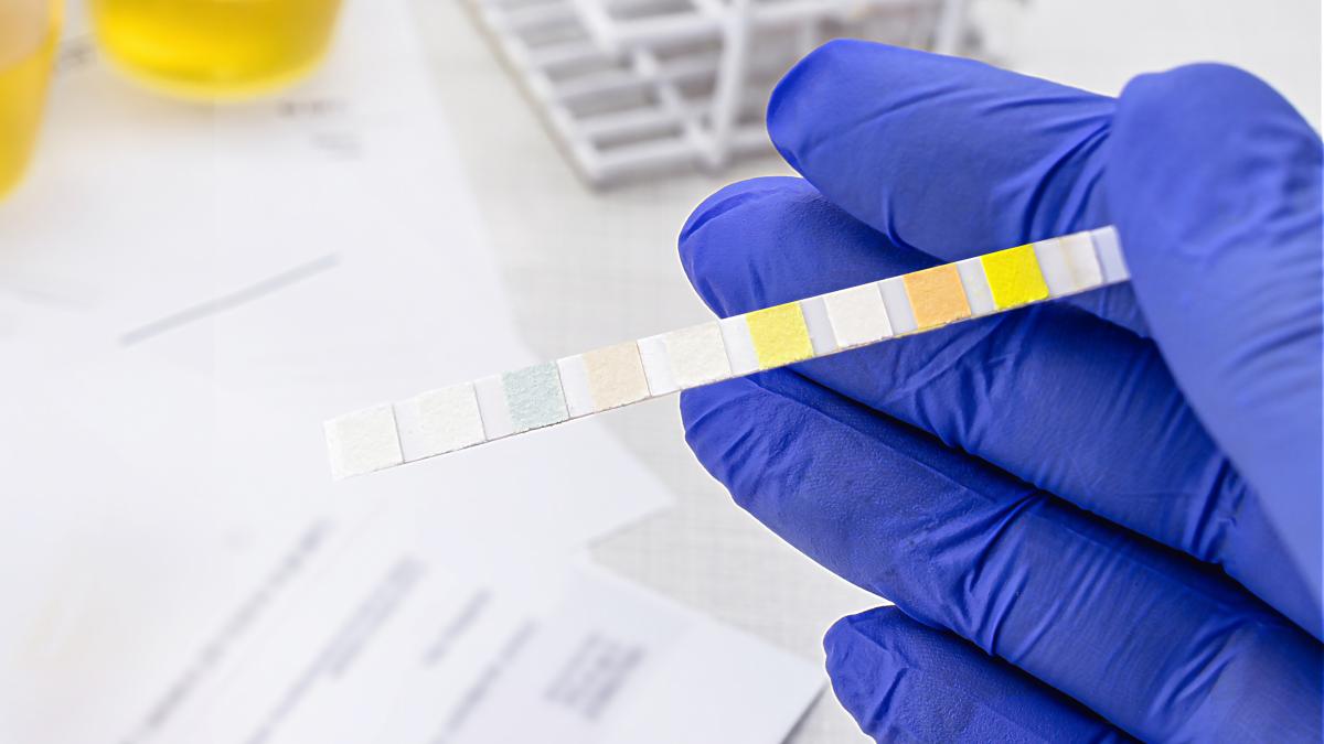 testul-care-iti-arata-daca-ai-hepatita--rezultat-in-10-minute--liana-velica-hepatita-c-se-poate-vindeca-hepatita-b-poate-fi-tinuta-sub-control_79316600