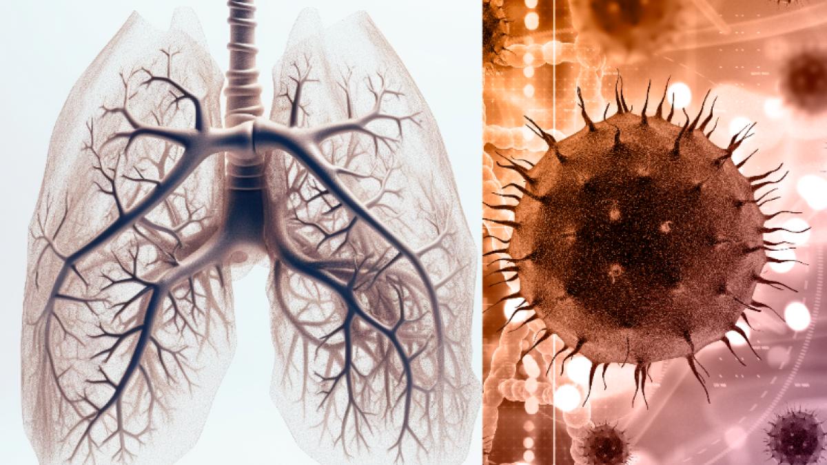 pneumonia-cu-plamani-albi-1_98711500
