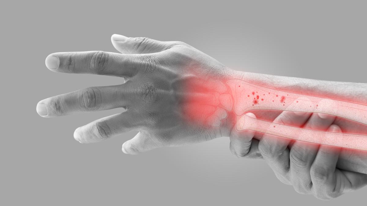 osteopenie_13623100