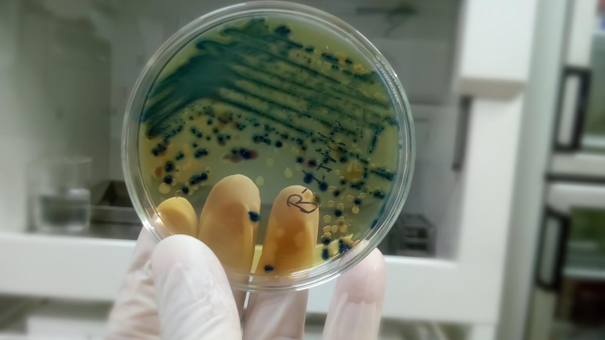 botulism-alimentar--boala-grava-din-casa--aruncati-acest-aliment-ciuhodaru-boala-e-mortala-cea-mai-puternica-bacterie_27474100