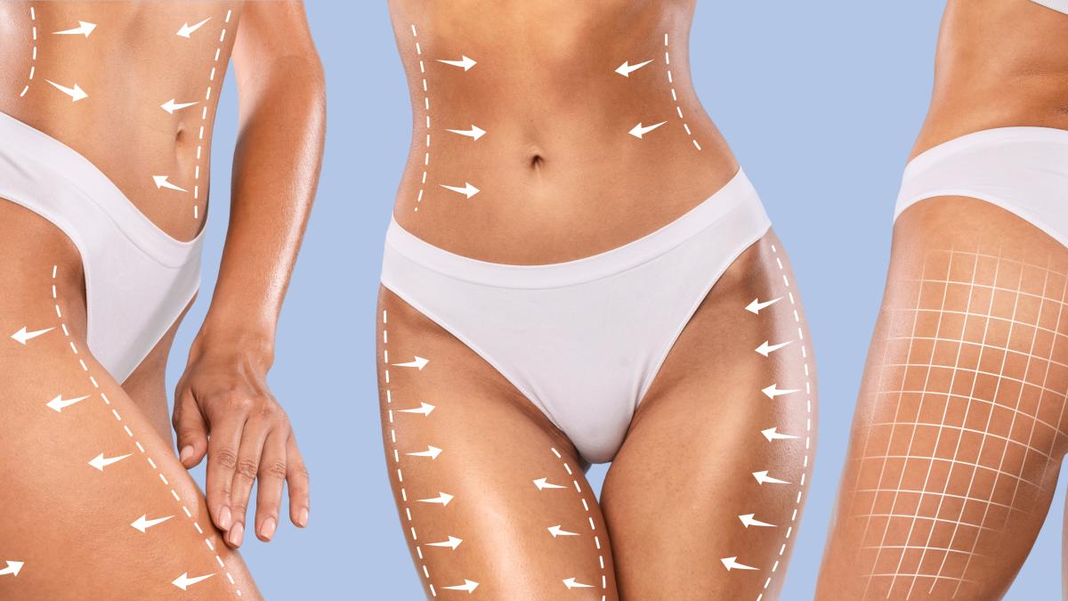 remodelare-corporala_48319900