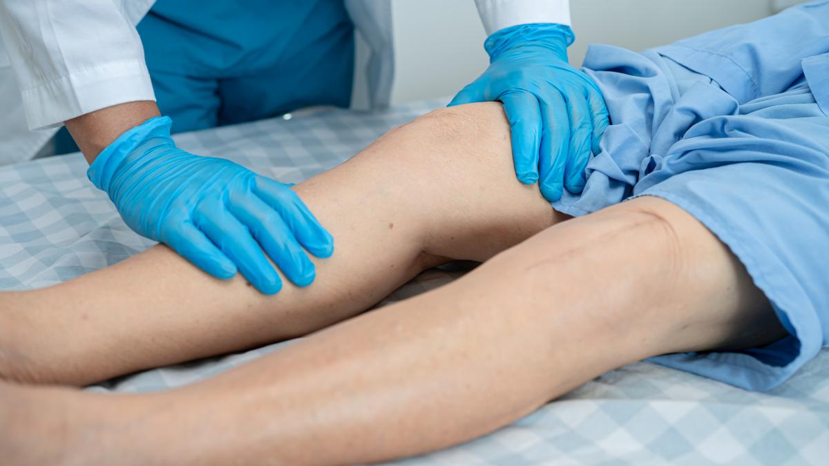 boala-cardiaca-mortala-care-poate-fi-confundata-cu-afectiunile-pielii-_67785600