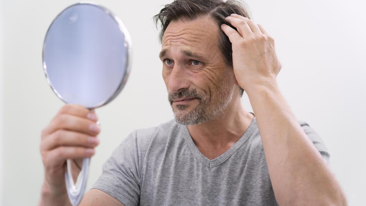 obiceiuri-care-duc-la-alopecie_62966600