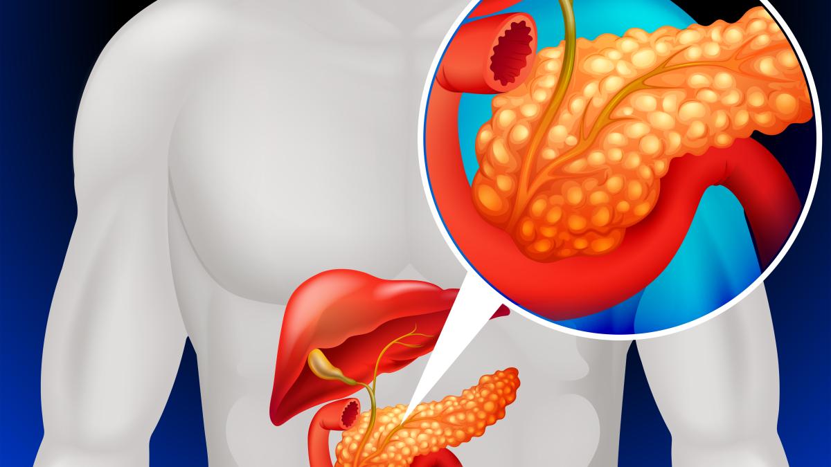 pancreatita_49183300