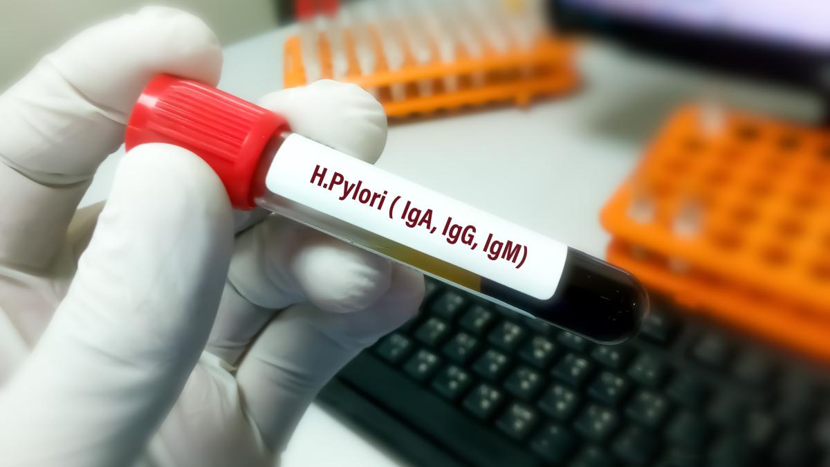 testarea-helicobacter-pylori-min_97242500