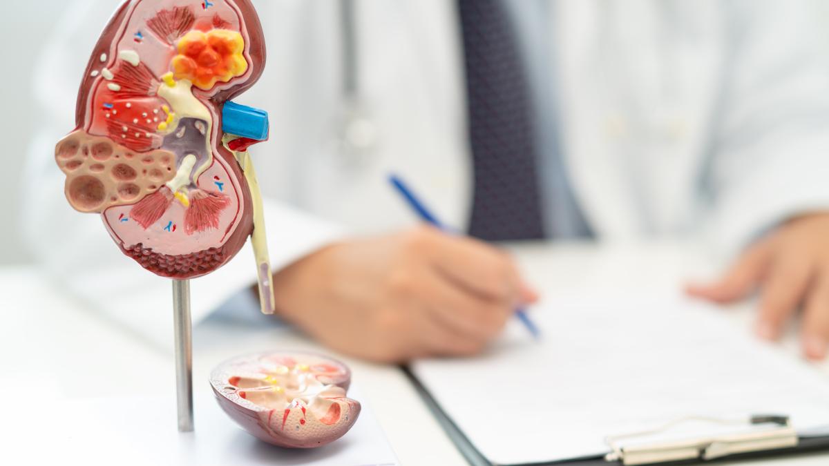 fda-aproba-medicamentul-impotriva-anemiei-cauzate-de-boala-renala-cronica_22618600