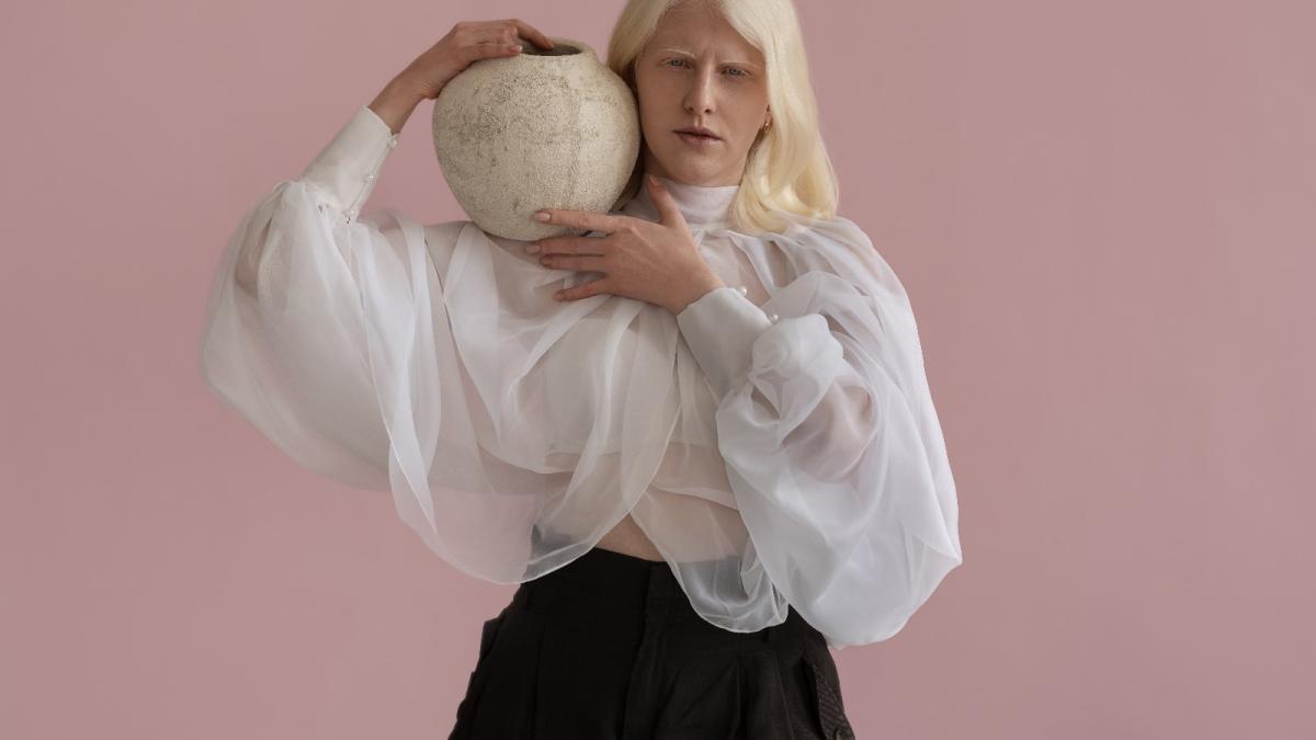 albinism_62633300