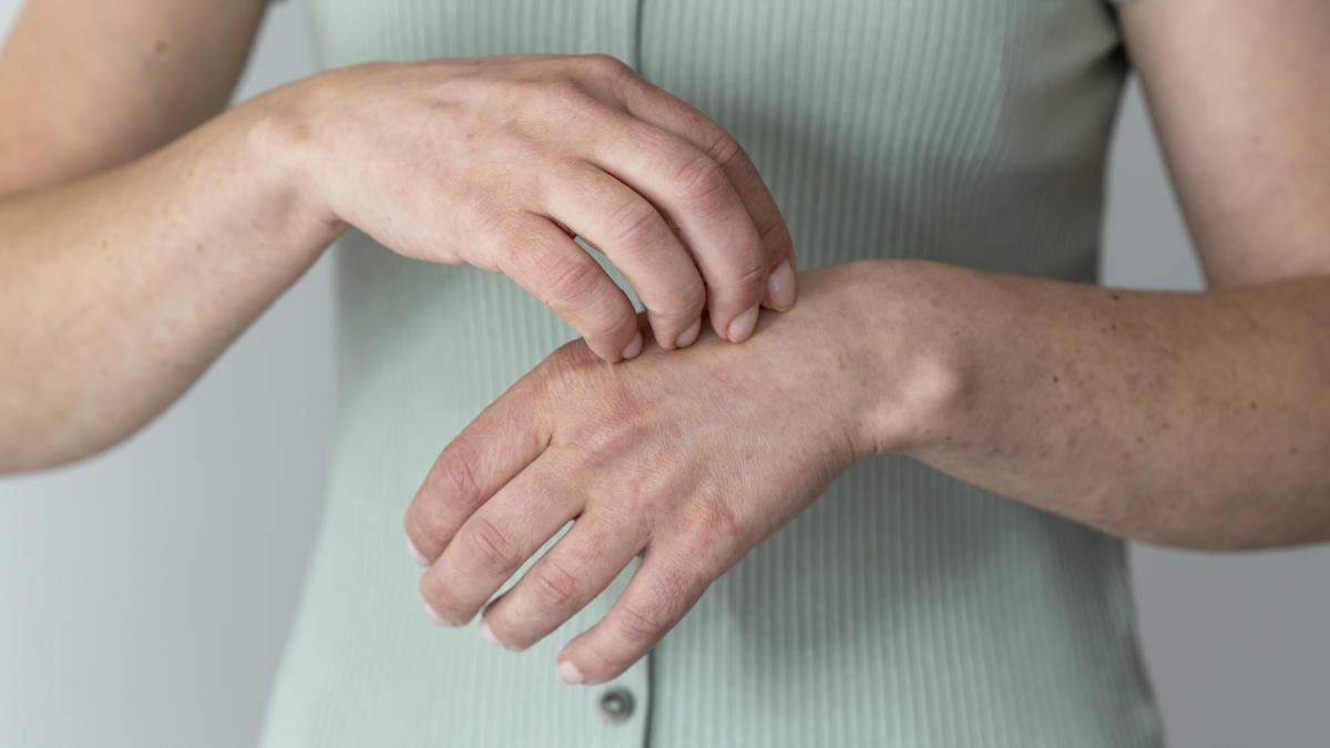 primul-semn-al-urticariei--si-stresul-o-poate-declansa--care-sunt-metodele-de-tratament_08485000