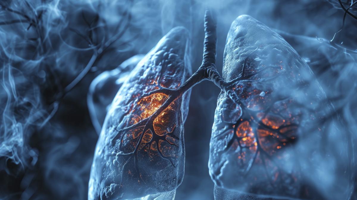 doua-cauze-majore-care-duc-la-cancer-pulmonar-_32812900