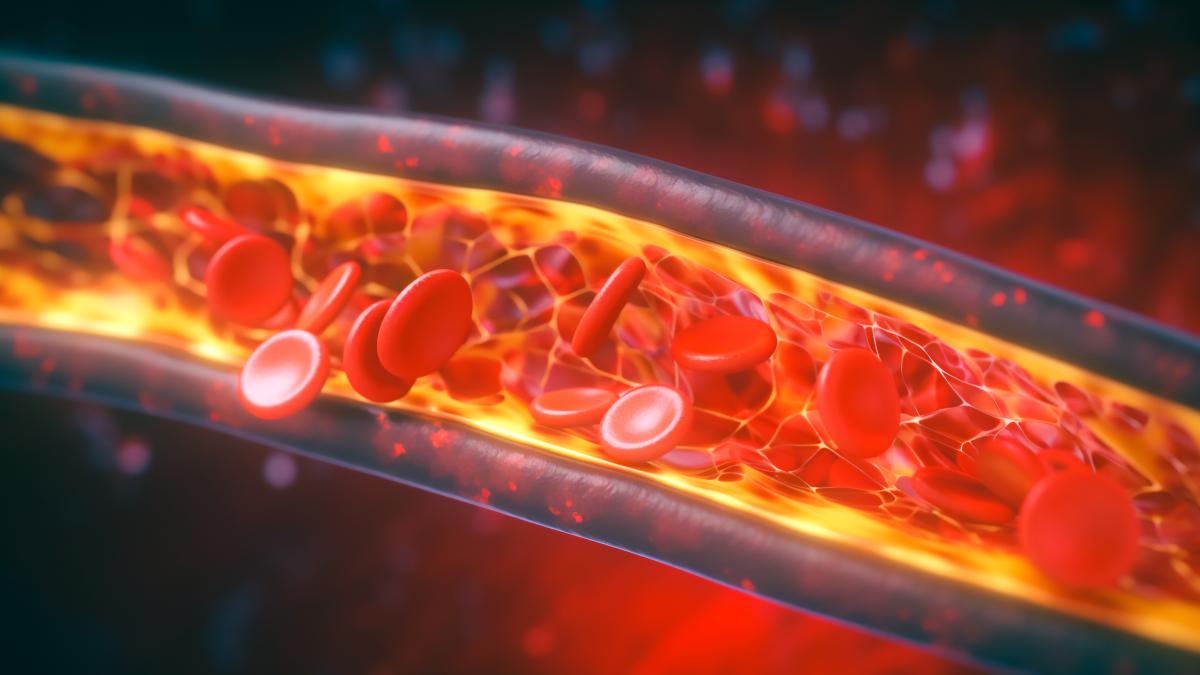 colesterol-alert--rezultate-alarmante-_07436000