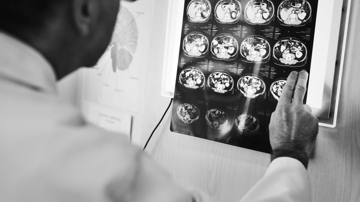 avc-urile-greu-de-diagnosticat-_48740900