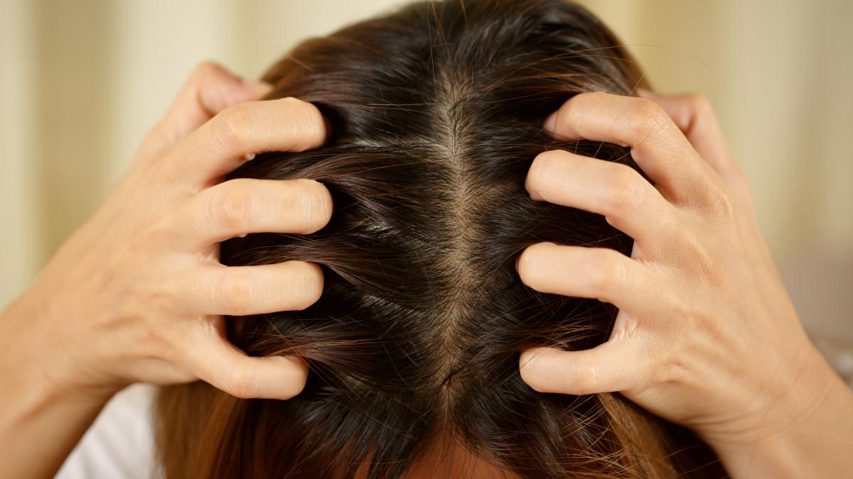 scalp1_28787900