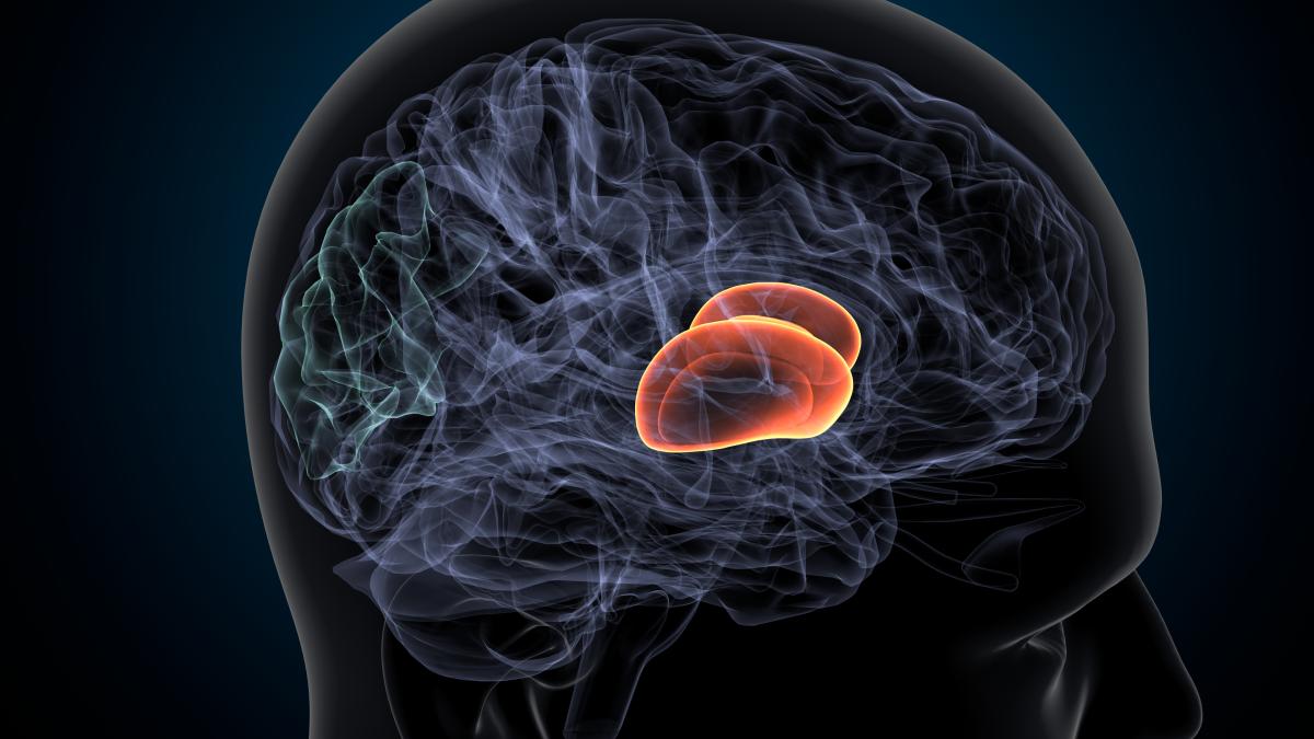 ce-este--de-fapt--atacul-ischemic-tranzitoriu-_88323500