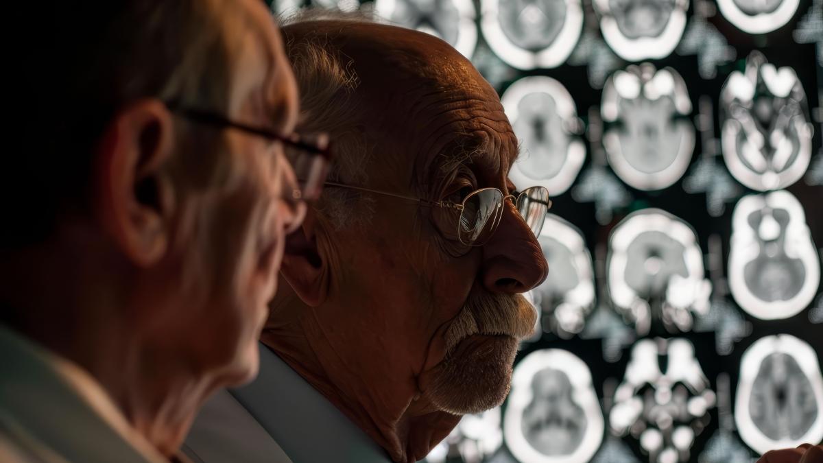 alzheimer_43327100