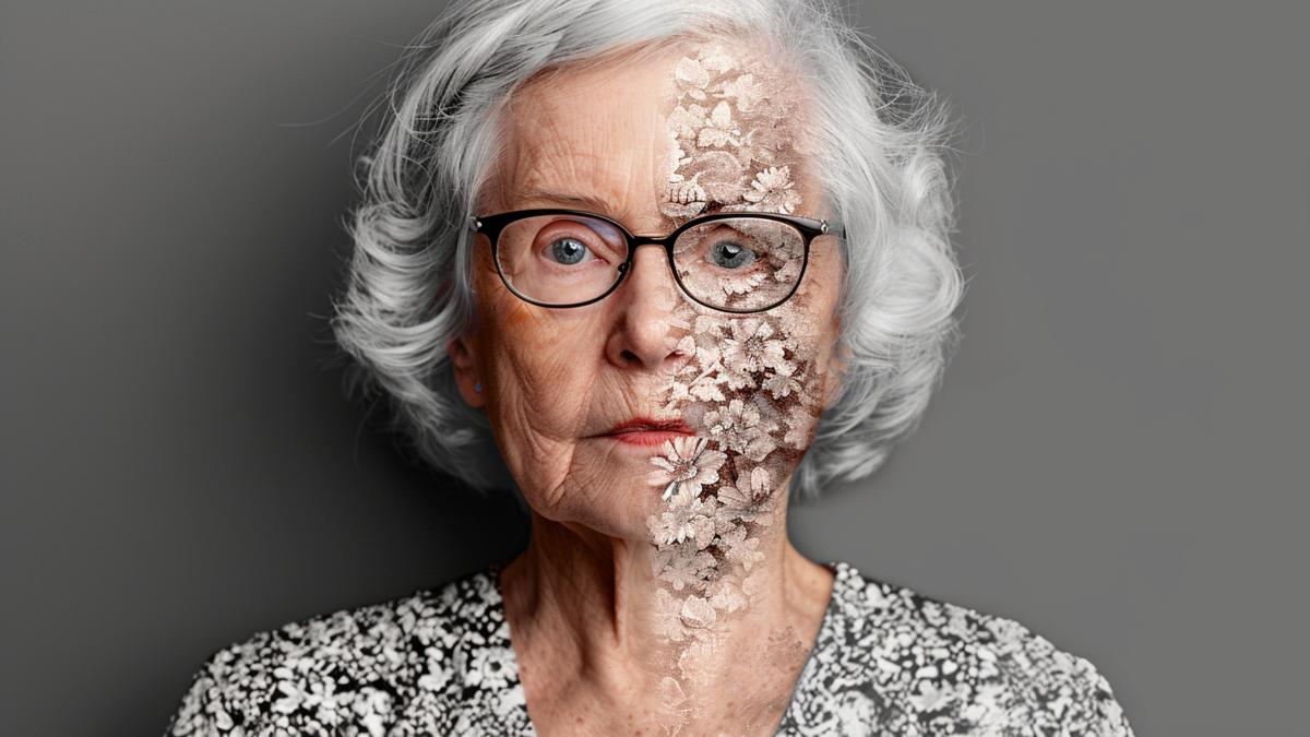 alzheimer_45404400